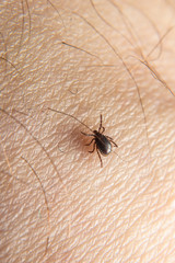 Forest mite on the skin. wood tick