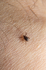 Forest mite on the skin. wood tick