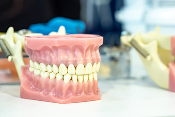 Removable denture. The model of the jaw. False teeth. Dental modeling. Prosthetic dentistry. Dentistry.