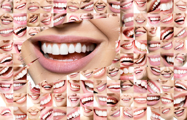Conceptual background of laughing human faces with great teeth and detail of young woman's beautiful smile . Healthy beautiful male and female smiles. Teeth health, whitening, prosthetics and care.