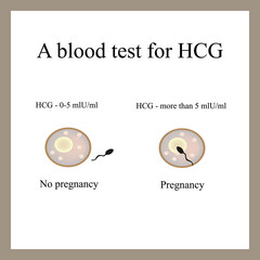 blood test for hCG. The pregnancy. fertilized egg. Infographics