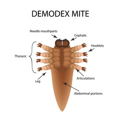 The structure of the demodex mite. Demodecosis. Infographics. Vector illustration on isolated background.