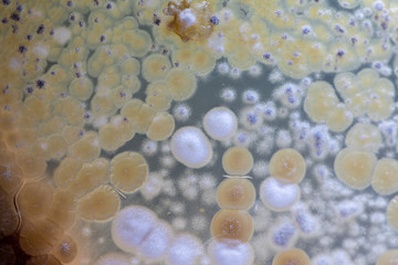 Study Colony characteristic of Actinomyces, Bacteria, yeast and Mold on selective media from soil samples for study in laboratory microbiology.