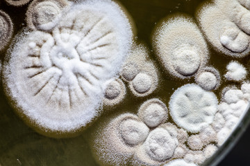Study Colony characteristic of Actinomyces, Bacteria, yeast and Mold on selective media from soil samples for study in laboratory microbiology.