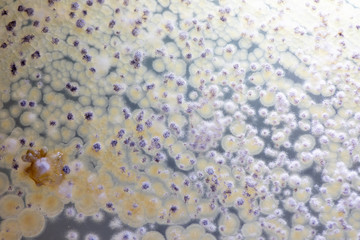 Study Colony characteristic of Actinomyces, Bacteria, yeast and Mold on selective media from soil samples for study in laboratory microbiology.