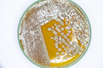 Study Colony characteristic of Actinomyces, Bacteria, yeast and Mold on selective media from soil samples for study in laboratory microbiology.