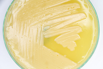 Study Colony characteristic of Actinomyces, Bacteria, yeast and Mold on selective media from soil...