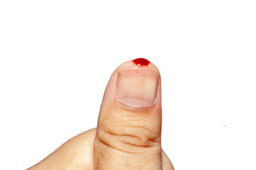 Close up blood on Thumb on white background