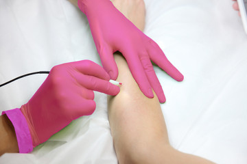 Female hand gloves when removing hair with electric hair removal device