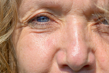 Single blue eye and nose of a middle-aged woman