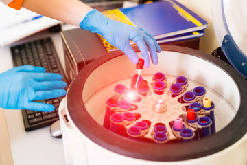 Doctor putting tubes of blood in centrifugal machine for testing and analyzing
