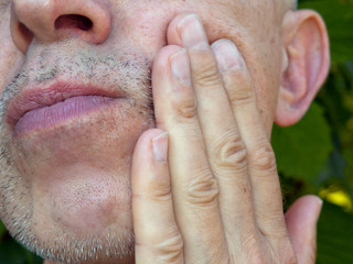 man with toothache