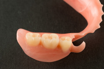 image of a modern denture