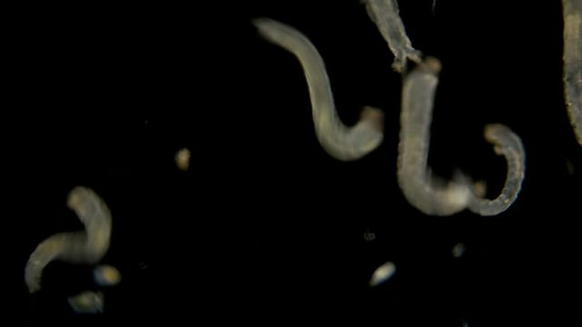 many mosquito larvae under the microscope, a lot of mosquito larvae under a microscope, randomly moving and twisting like worms, is fish food, fishing bait and a very annoying insect for humans