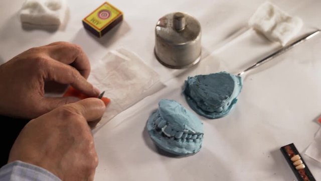 Precise cutting of modelling wax for removable partial denture procedure, close up shot