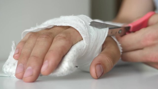 removing splint from wounded arm