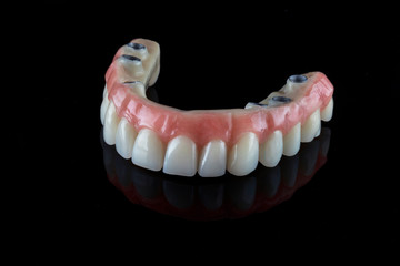 realistic dental permanent upper jaw prosthesis for a 50-year-old patient on a black background