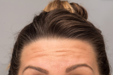 A closeup view on the eyebrows, forehead and hairline of a young Caucasian woman with brunette...