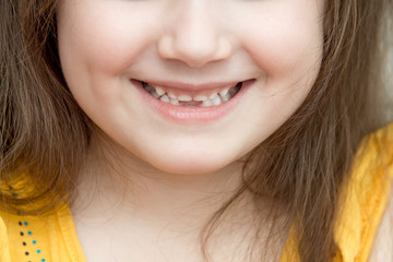 Childish face lower part with missing front lower milk teeth in a smiling mouth