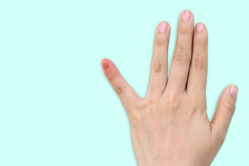 Close up of nail fungus infection on the little finger. Human hand suffering from fungus infection. Onychomycosis with fungal nail infection on nail isolated over soft background. Clipping path.
