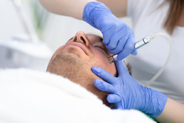 Obraz na płótnie Canvas Man on lifting laser rejuvenation face at beauty salon