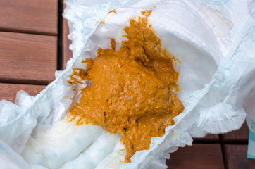 Child orange diarrhea excrement inside of stinky diaper. Close up.