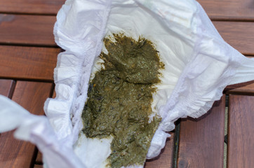 Child dark green and brown coloured  diarrhea excrement inside of stinky diaper. Close up.