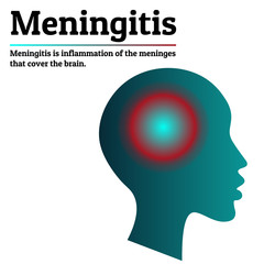 Medical infographic template. Meningitis - brain meninges inflammation. Human head silhouette with inflammation localization sign mark. Copy space for your text. For poster, presentation, brochure.