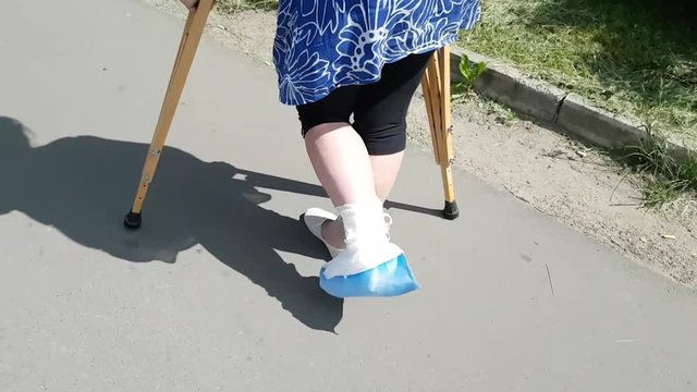 A woman with a broken leg in a white medical plaster jumps on crutches. A difficult life situation for an adult. Limited mobility in adulthood. Street