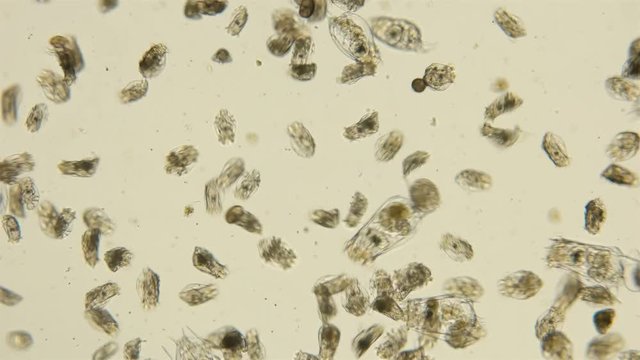 The colony of plankton rotifers Rotifera under a microscope, fast and chaotic movement, are zooplankton, fish food, distributed throughout the world, both in salt and fresh water,