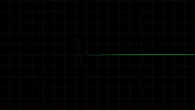3D animation of a heartbeat frequency on an electrocardiogram. Healthcare.