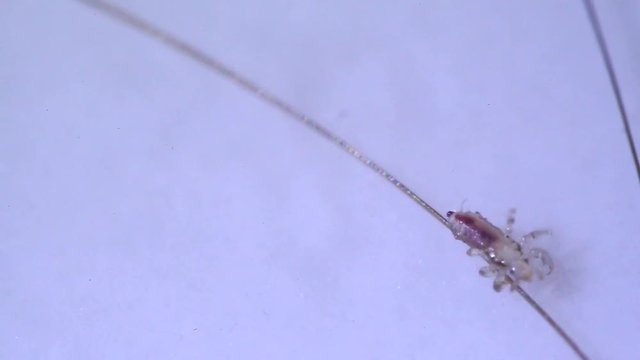 Louse isolated on a white background moving through a hair, moving the antentas and advancing on the hair. With blood inside moving through his body.