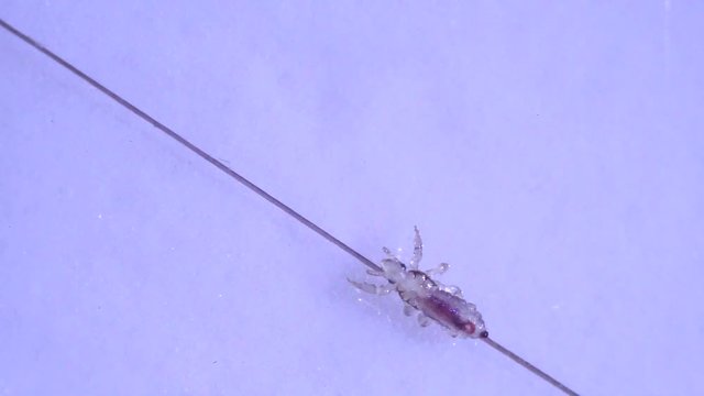 Louse isolated on a white background moving through a hair, moving the antentas and advancing on the hair. With blood inside moving through his body.