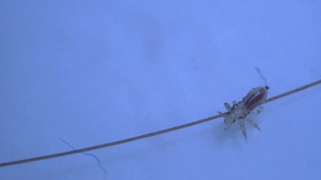 Louse isolated on a white background moving through a hair, moving the antentas and advancing on the hair. With blood inside moving through his body.