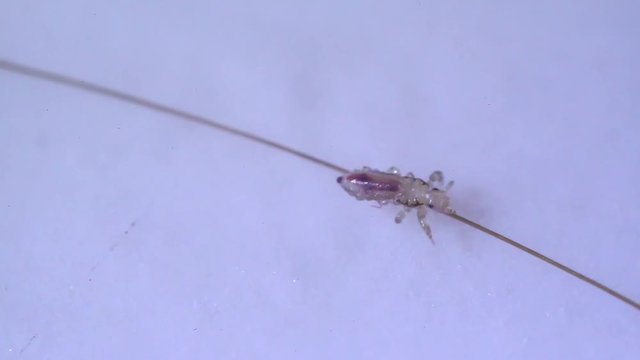 Louse isolated on a white background moving through a hair, moving the antentas and advancing on the hair. With blood inside moving through his body.