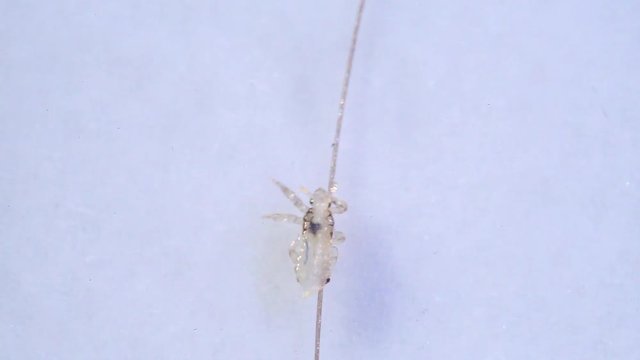 Louse isolated on a white background moving through a hair, moving the antentas and advancing on the hair. With blood inside moving through his body.