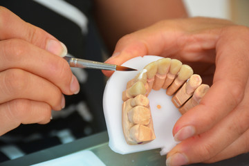 Zahntechniker im Dental Labor Schneidezahn mit Keramik schichten. © JOE LORENZ DESIGN