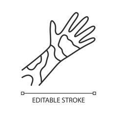 Contact dermatitis, hives linear icon