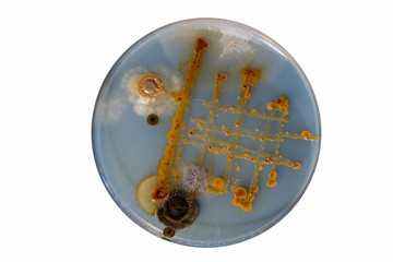 petri dish with bacteria, isolated