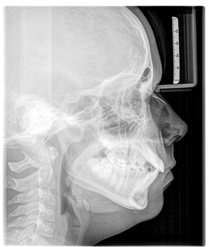 FRS eines jungendlichen Patienten