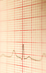 Cardiogram