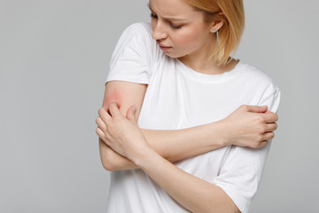 Close up of young woman scratching the itch on her hand, isolated on grey background. Dry skin, animal/food allergy, dermatitis, insect bites, irritation concept.  - obrazy, fototapety, plakaty