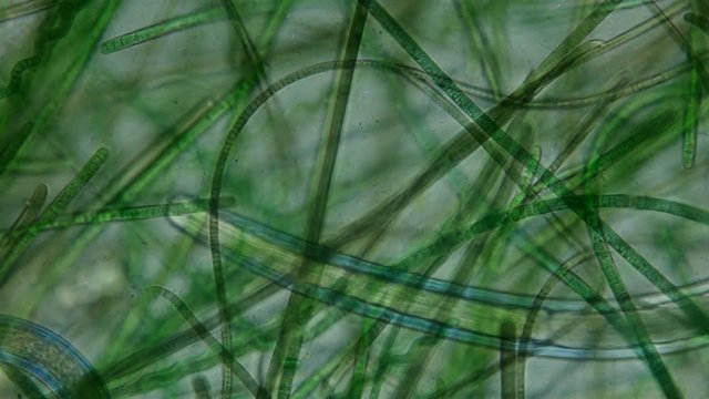 nematode worm under a microscope, worm movement among algae, widely distributed on the ground, is a parasite, the exact form is not defined