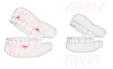 human jaw. 3d vector layout. medicine and health. pain teeth.