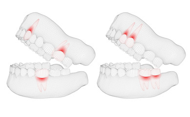 human jaw. 3d vector layout. medicine and health. pain teeth.
