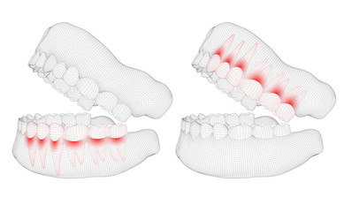 human jaw. 3d vector layout. medicine and health. pain teeth.