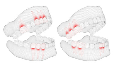 human jaw. 3d vector layout. medicine and health. pain teeth.