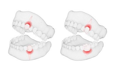 human jaw. 3d vector layout. medicine and health. pain teeth.