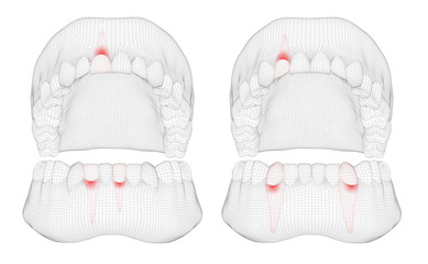 human jaw. 3d vector layout. medicine and health. pain teeth.