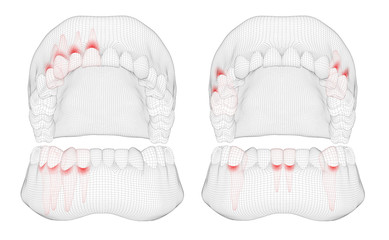human jaw. 3d vector layout. medicine and health. pain teeth.